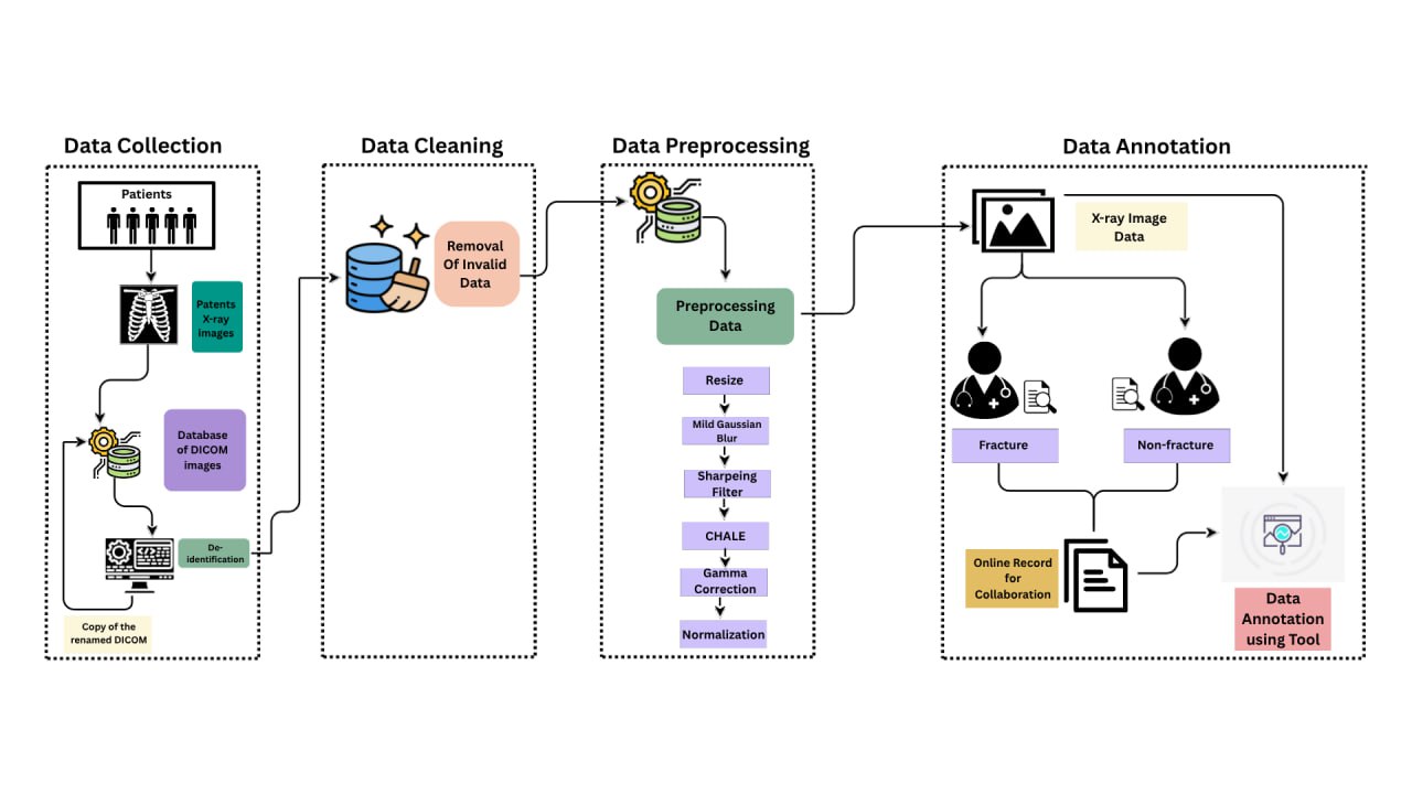 A Deep Learning-Based System for Accurate Bone Fracture Detection from X-ray Images